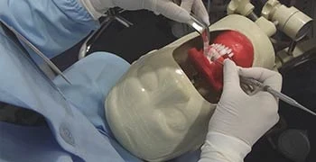 Uso de Bisturi Elétrico na Endodontia