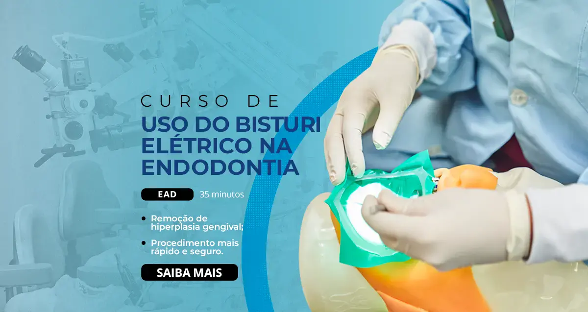 Uso de bisturi elétrico na Endodontia - EAD